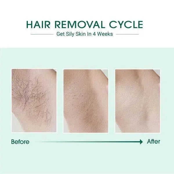 Laser Hair Removal-beauty products-Evelyns Fashion